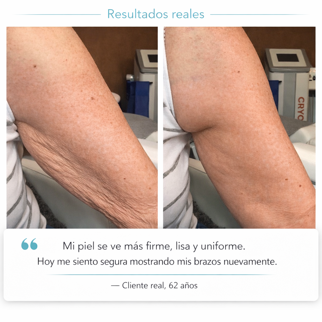 Tratamiento Corporal | Reafirmante & Anticelulitis